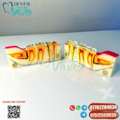 Tooth Model Decomposition Model Of Lower Right Posterior Teeth