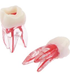 RCT Tooth Training Upper #6 with Access opened