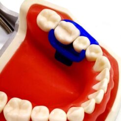 Dental MiniDam