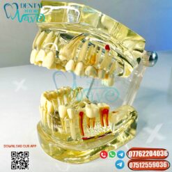 Clear Dental Model with Removable Teeth for Dentist