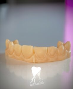 Veneer Training Model